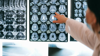 Top 3 neurologi recomandă alimentul-minune pentru creier sănătos