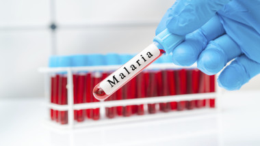 Trei copii suspectați de malarie după vacanță în Africa. Anunțul ministrului