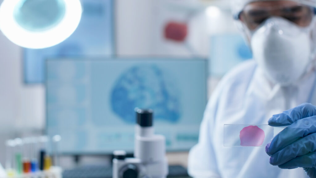 Bacterii, nu chimioterapie: Nouă armă împotriva cancerului