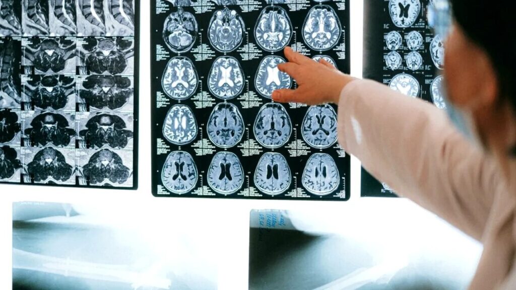 Cercetător german descifrează secretul busolei interne a creierului uman