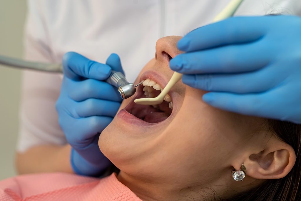Adio freza dentară! Cu ce tehnologie revoluționară va fi înlocuită