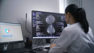 60-70% din AVC-uri au cauze controlabile legate de stilul de viaţă