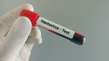 Hantavirusul, infecția mortală care a ucis trei oameni pe o navă de croazieră
