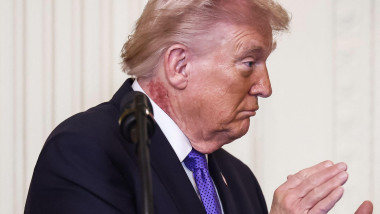 Trump, la control medical pentru a treia oară în 13 luni, înainte de a împlini 80 de ani