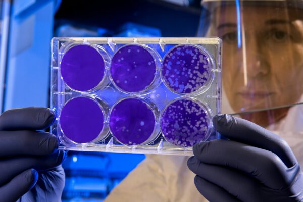 Toxiinfecție la nunta șefului IPJ Iași: Salmonella din salată, cauza principală
