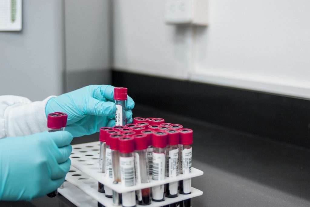 Hantavirus suspectat la pacient din Arad internat în 2023, 15 cazuri în România