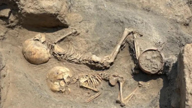 Intervenție chirurgicală veche de 4.000 de ani, descoperită în Asia Centrală
