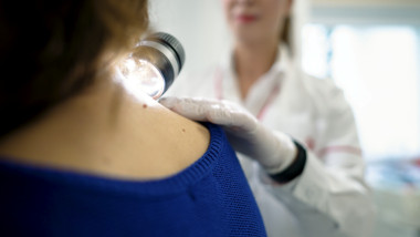 Spitalul Euroclinic lansează primul centru de tratare a melanomului din România