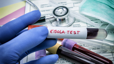Ebola: virusul poate rămâne latent luni sau ani în organism și reapărea