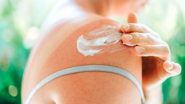 Cremă cu SPF: arma împotriva cancerului de piele explicată de dermatologi