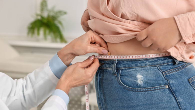 Obezitatea la tineri deschide drumul către diabet, infarct și AVC: „Trebuie văzută ca o boală tratabilă…