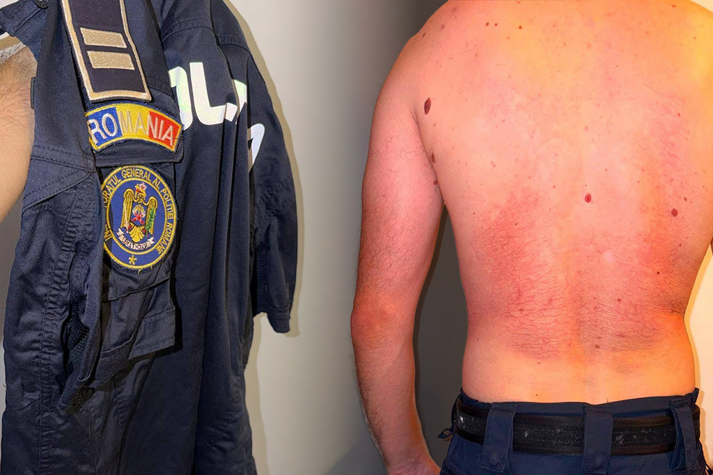 Sindicatul Europol critică obligativitatea purtării vestei antiînjunghiere. Prezintă imagini cu efectele asupra pielii după purtarea ei 8 ore/ Reacția Poliției