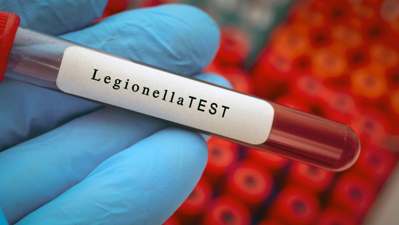 Legioneloză la Basel: un mort, risc de pneumonie severă