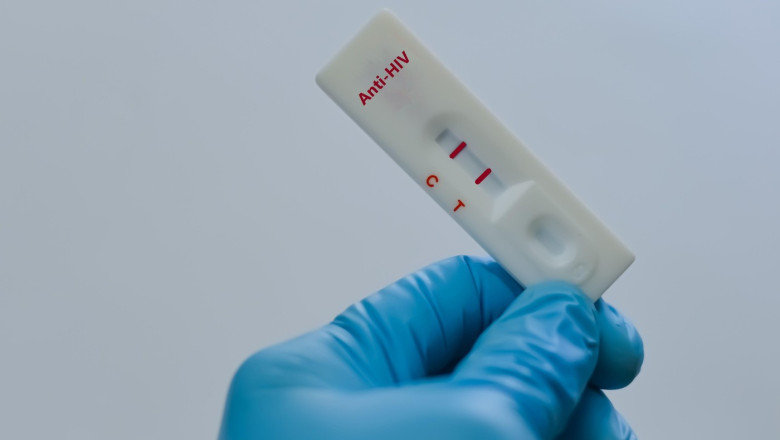 Rusia afirmă că rata infecțiilor cu HIV este în scădere, dar experții nu sunt atât de siguri